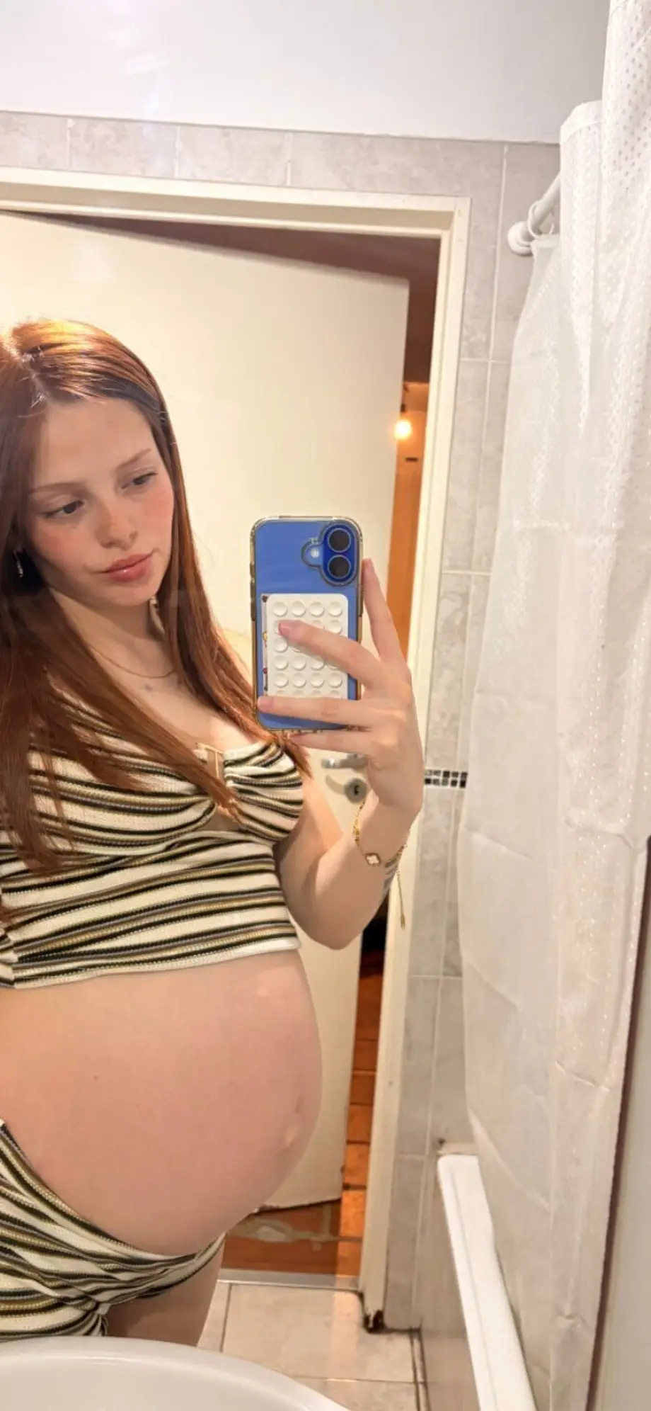 MIA 18 Freshly pregnant 💗